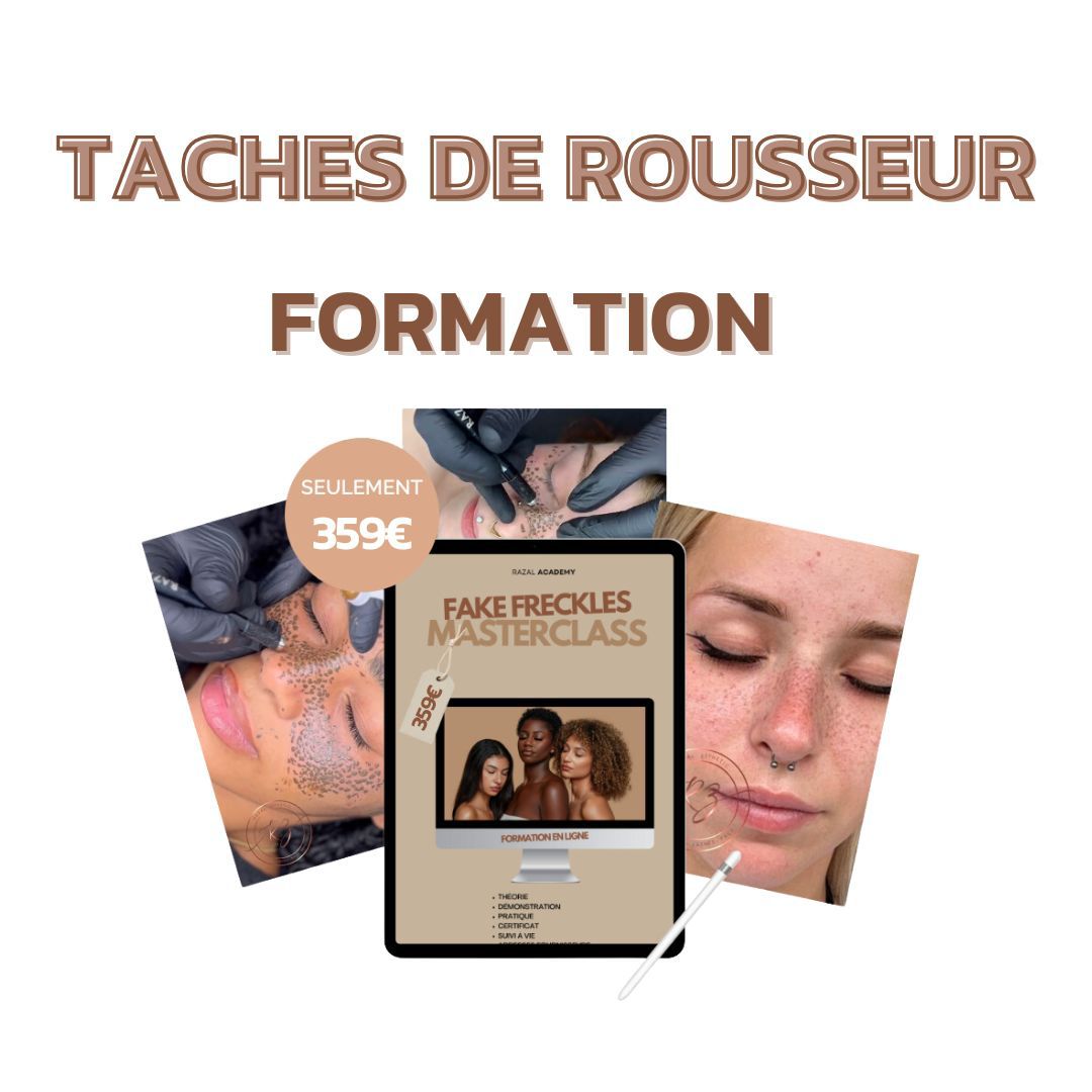 Tache de rousseur